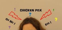 Chicken pox!!!!